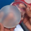 silicone breast implants with rough and smooth surfaces