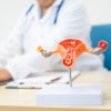 womans ovary