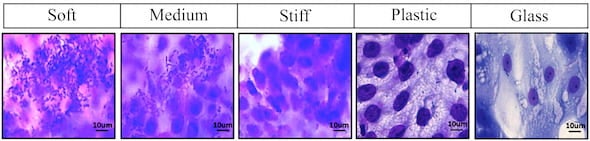 A comparison of E. coli cultures on enteroids grown on a selection of surfaces shows hydrogels developed at Rice University are effective mimics of intestinal environments for lab experiments.