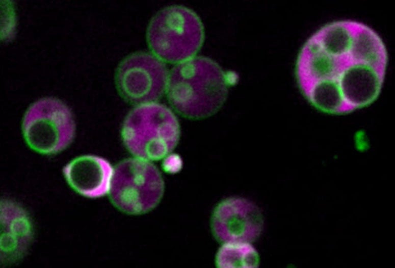 Membrane-separated compartments are visible inside the peroxisomes of 4-day-old Arabidopsis thaliana plant cells in this image from a confocal microscope.