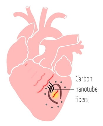 Heart Diagram