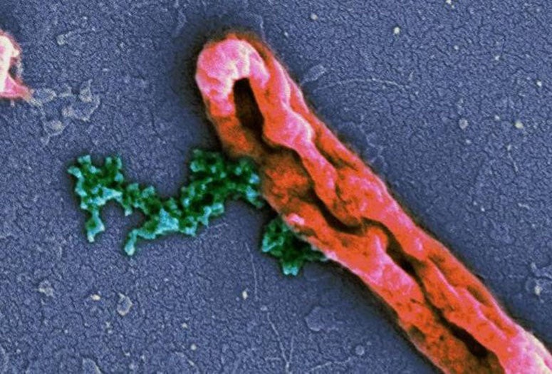 An electron microscope image shows intact Escherichia coli bacteria at top and E. coli leaking chromosomes (green) after disruption by an antimicrobial peptide at bottom. New models by Rice University scientists have determined peptides that invade bacteria and do their damage from the inside are underrated. Source: Wikipedia