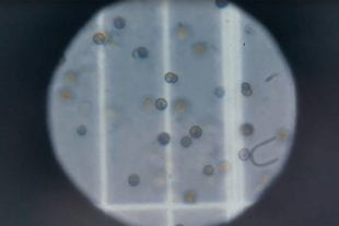 Dinoflagellates as seen under a microscope. Dinoflagellate species can appear identical under a microscope, but differences between groups are detectable by DNA analysis. (Image courtesy of Correa Lab/Rice University)