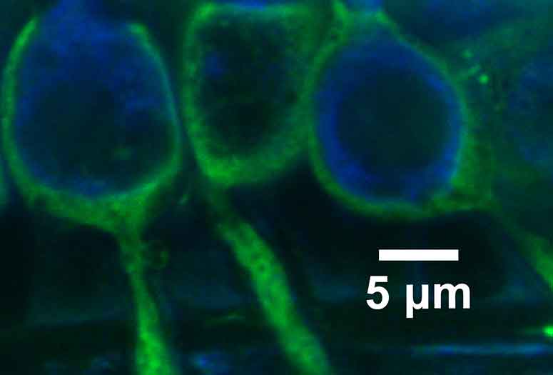 microscopic image of vestibular hair cell-calyx synapses