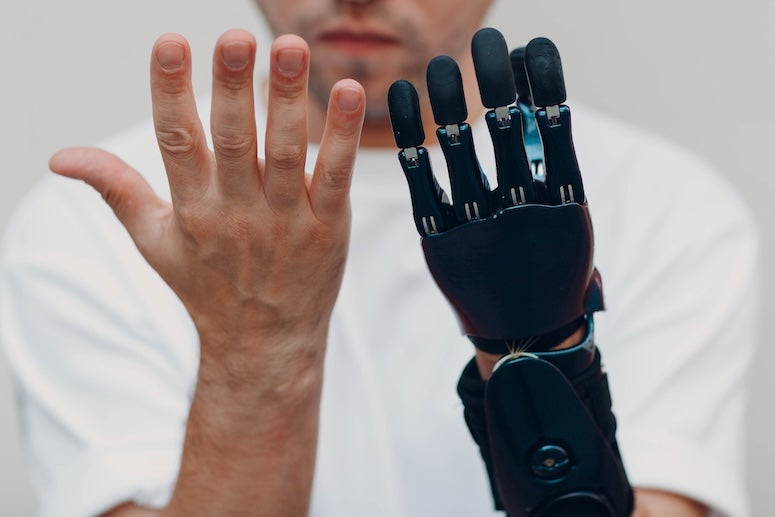 Prosthetic hand