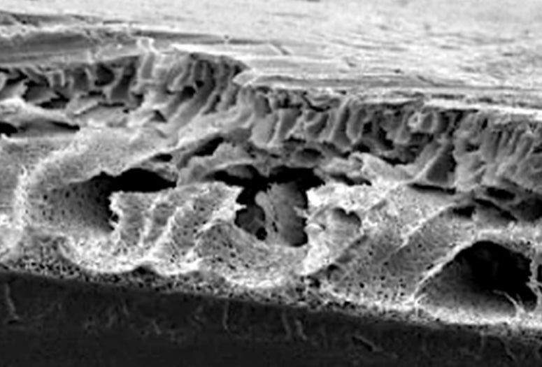 SEM image