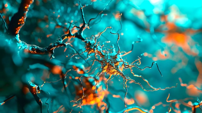 Stock photo of amyloid