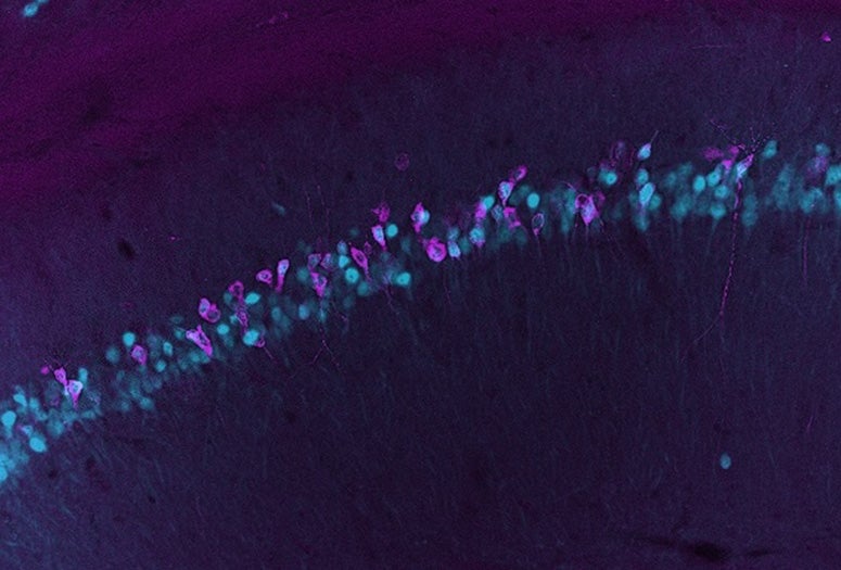 microscopy slide