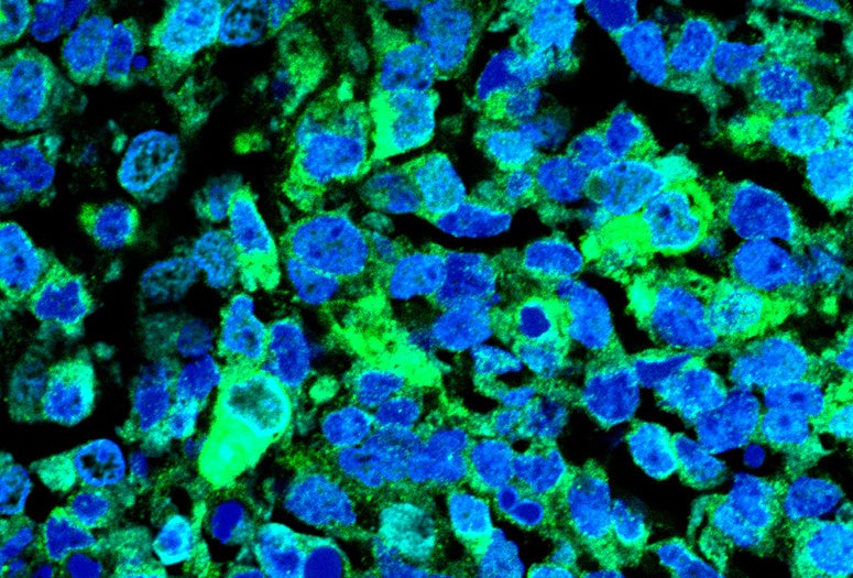 microscopy slide of stained Ewing sarcoma tumor in mouse
