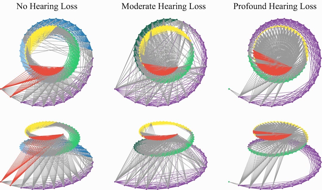 graphs of cochlea