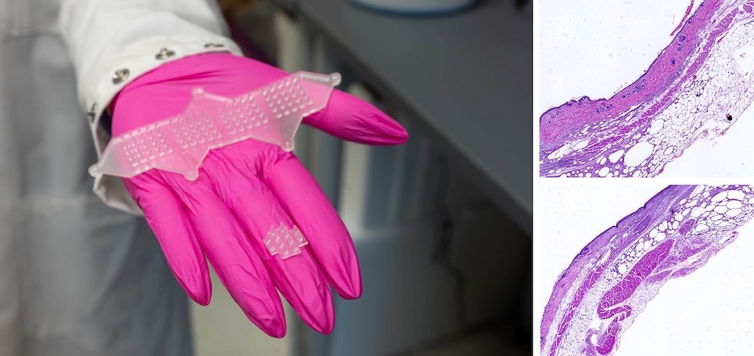 gloved hand holding wound healing patches and histology images