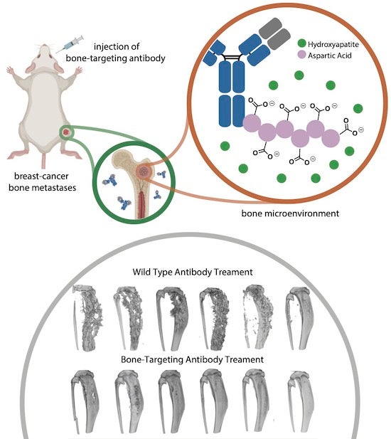 Scientists at Rice University added a bone-targeting peptide to an antibody used to fight breast cancer to curtail metastasis to the bone. Illustration by the Xiao Research Group