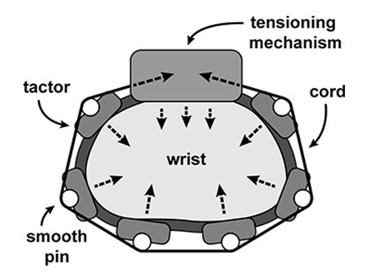 Illustration of the components in the Tabsi mechatronic bracelet