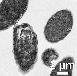 A transmission electron microscope image shows Escherichia coli bacteria in various stages of degradation after exposure to light-activated molecular drills developed at Rice University. The machines are able to drill into the membranes of antibiotic-resistant bacteria, killing them in minutes. (Credit: Image by Matthew Meyer/Rice University)