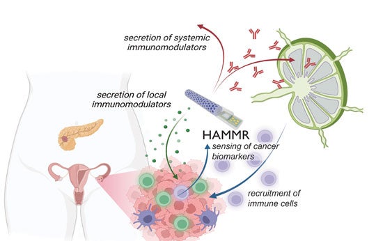 A figure illustrating how a “closed-loop” implant called HAMMR will be used to treat recurrent ovarian cancer.