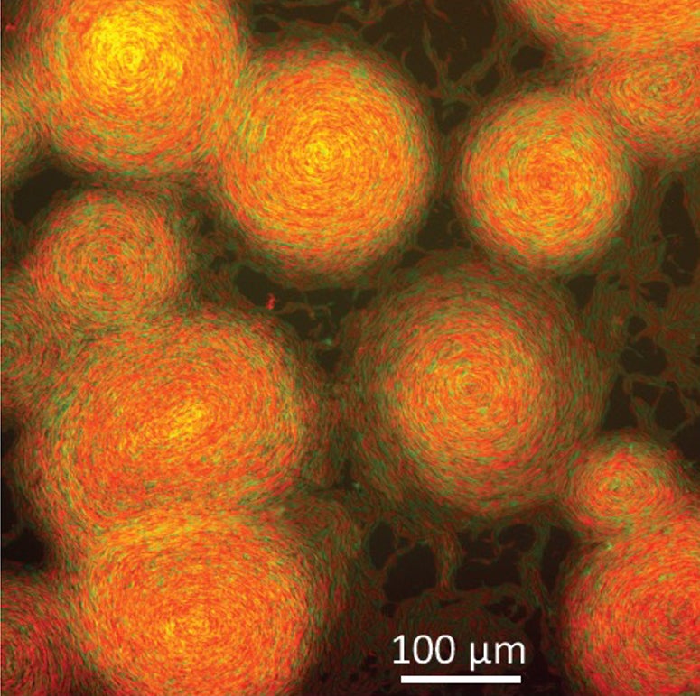 Swirls of bacteria appear orange and red with specks of green
