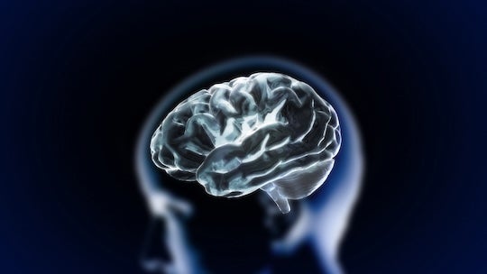 Brain image