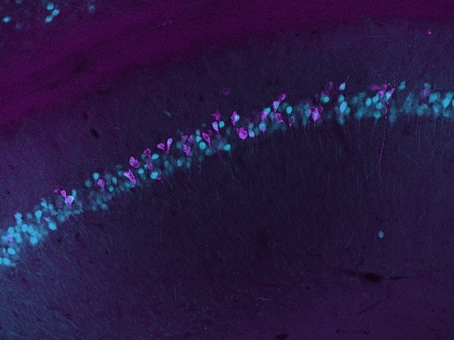 microscopy image