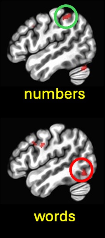 Pilot data from a collaborative functional magnetic resonance imaging (fMRI) project between University of Pittsburgh and Rice University. The data shows a participant's brain activity while reading words and numbers in braille, with distinct patterns of brain activity depending on what is being read.