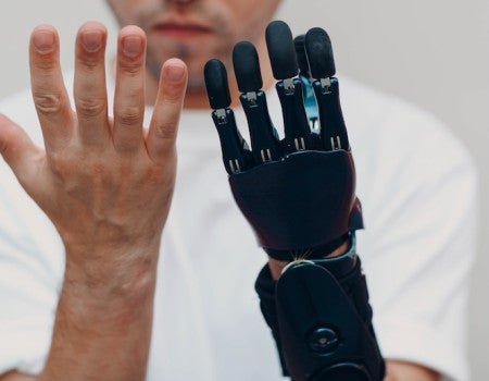 Stock photo of prosthetic hand
