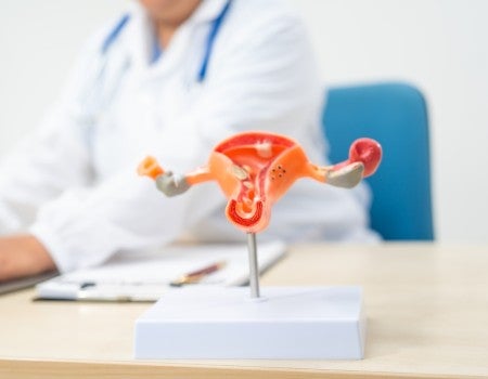womans ovary