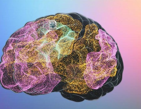 schematic of a brain with a small circular device provided for scale 