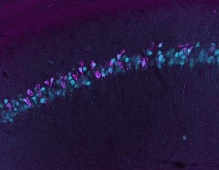 microscopy slide
