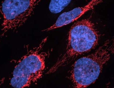 Microscopic view of human heart muscle cells against a dark background, showing cell nuclei stained bright blue surrounded by intricate networks of mitochondria highlighted in vivid red.