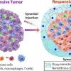 SynerGel, combines a pair of antitumor agents into a gel that can be injected directly into tumors, where they not only control the release of drugs but also remove suppressive immune cells from the tumor's microenvironment.