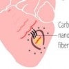 carbon nanotube fibers