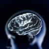 Image of brain