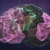 brain graphic courtesy of Motif Neurotech