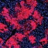 tissue scan