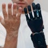 Stock photo of prosthetic hand