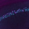 microscopy slide