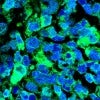 microscopy slide of stained Ewing sarcoma tumor in mouse 