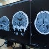 Brain imaging will help researchers examine how neural networks may be related to participants’ response to the music creativity intervention. (Stock image)